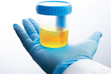 laboratory analysis urine|urine analysis near me.